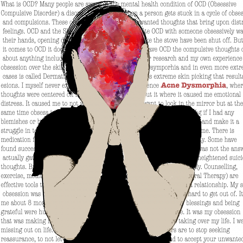 Acne Dysmorphia